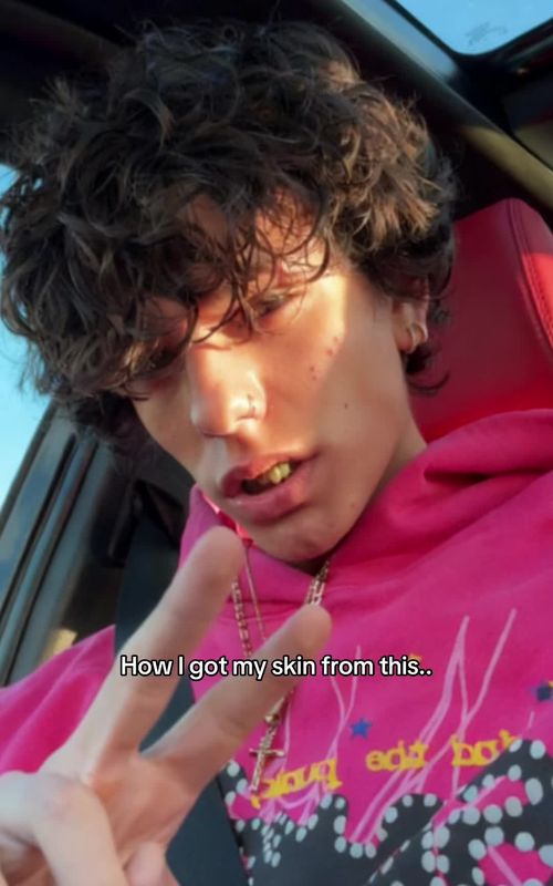 How I got my skin from this..